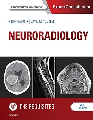 Full Download Neuroradiology: The Requisites E-Book (Requisites in Radiology) - Rohini Nadgir file in PDF