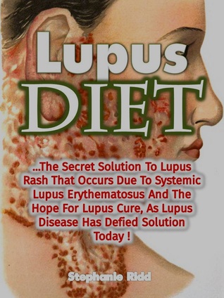 Download Lupus Diet: The Secret Solution To Lupus Rash That Occurs Due To Systemic Lupus Erythematosus And The Hope For Lupus Cure, As Lupus Disease Has Defied Solution Today! - Stephanie Ridd | ePub