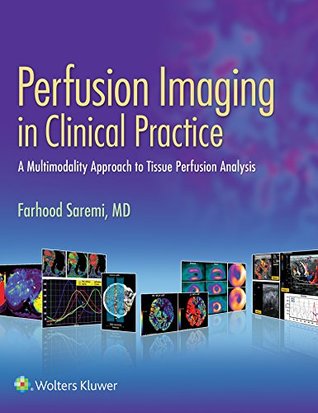 Read Perfusion Imaging in Clinical Practice: A Multimodality Approach to Tissue Perfusion Analysis - Farhood Saremi file in ePub