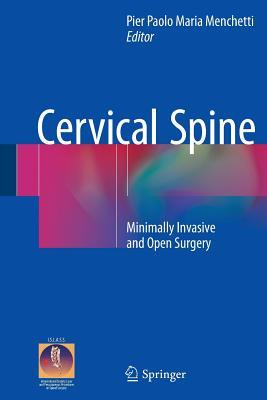Download Cervical Spine: Minimally Invasive and Open Surgery - Pier Paolo Maria Menchetti file in ePub
